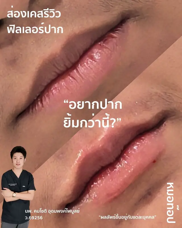Video cover: Video from Doctor Top Clinic · 2026-06-10