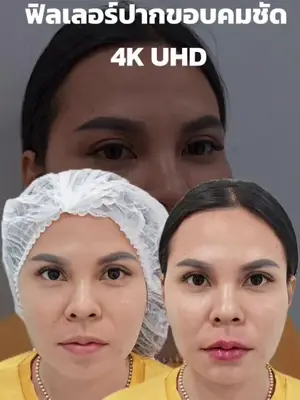 ภาพปกวิดีโอ: ฟิลเลอร์ปากขอบคมชัดแจ๋ว ความละเอียด 4K UHD