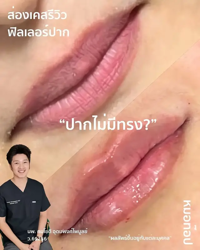 Video cover: Video from Doctor Top Clinic · 2026-06-15
