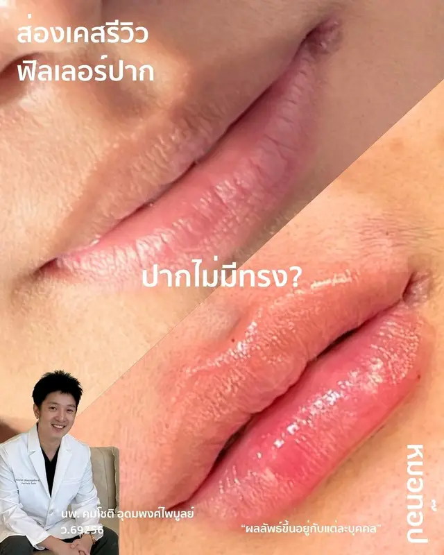 Video cover: Video from Doctor Top Clinic · 2026-06-07