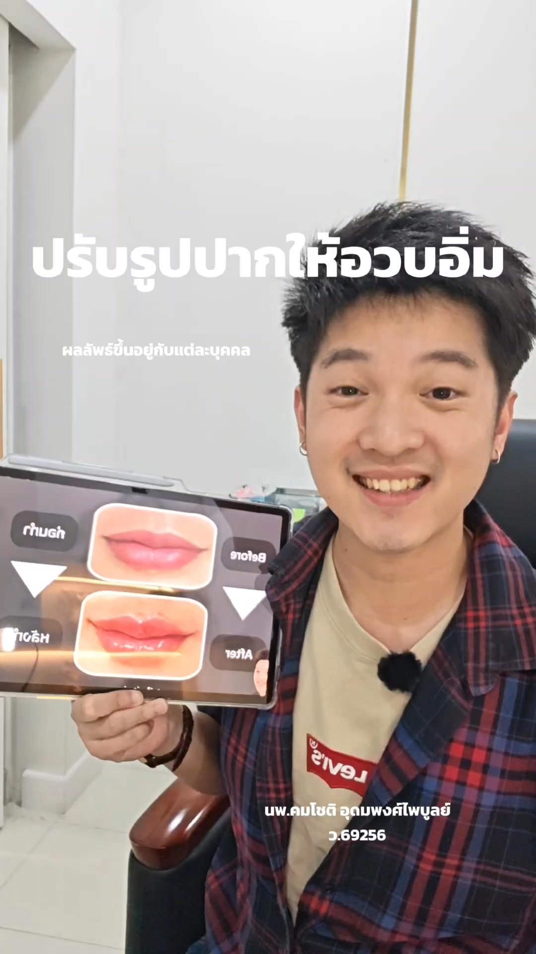ภาพปกวิดีโอ: ปรับให้อวบอิ่ม จุบุๆ ━━━━━━━━━━━━━━━━ ดูแลโดยหมอท๊อป 👨🏻‍⚕นพ. คมโชติ อุดมพงศ์ไพบูลย์ (ว.69256