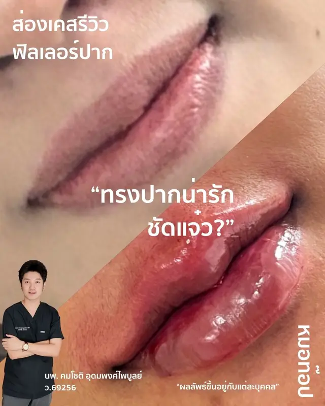 Video cover: Video from Doctor Top Clinic · 2026-07-11