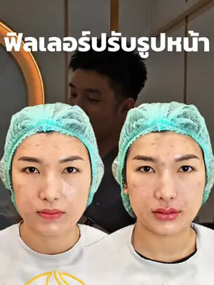ภาพปกวิดีโอ: วันนี้ปรับรูปหน้ากันครับ