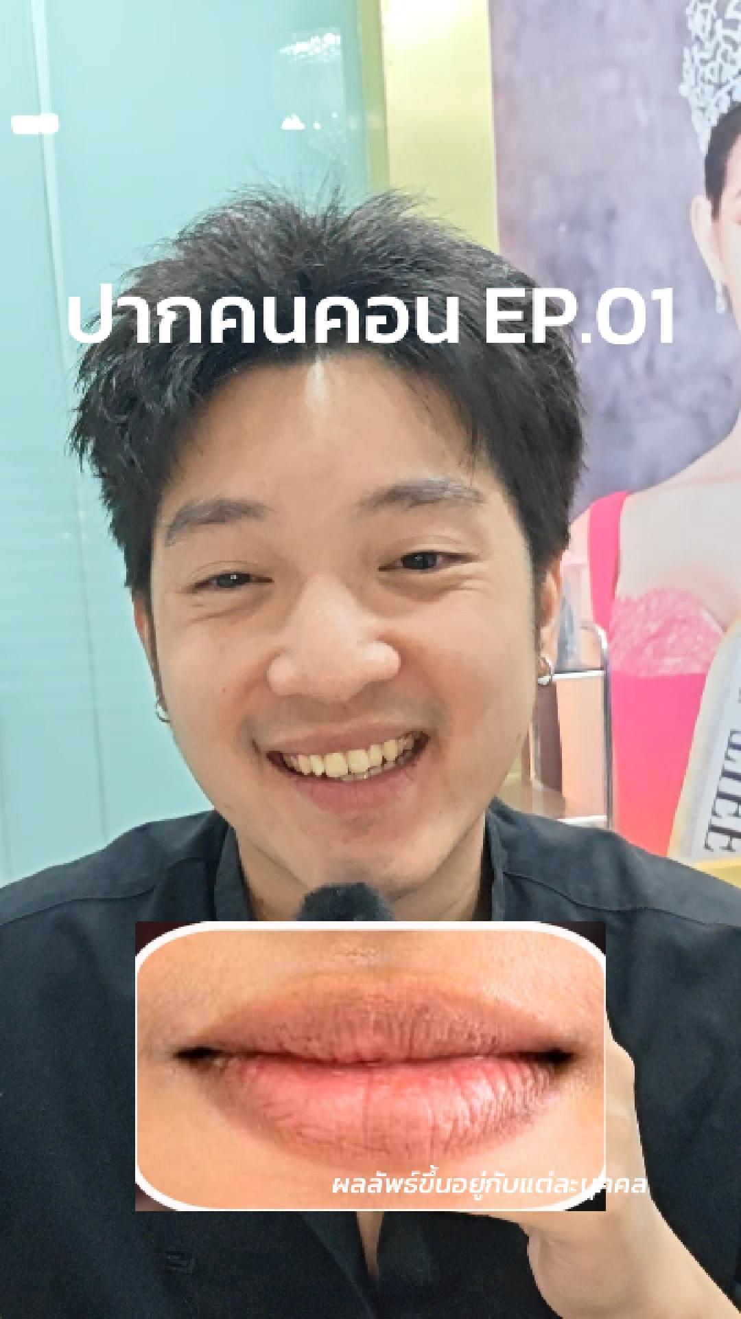 ภาพปกวิดีโอ: ฟิลเลอร์ปากคนคอน EP.01