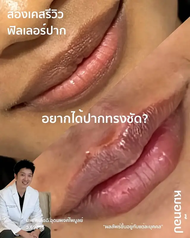 Video cover: Video from Doctor Top Clinic · 2026-06-27