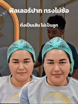 ภาพปกวิดีโอ: ฟิลเลอร์ปาก ทรงไม่ซ๊อ