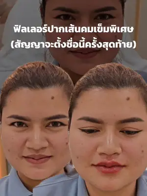 ภาพปกวิดีโอ: ฟิลเลอร์ปากเกาหลีกล่องส้ม ขึ้นทรงจึ้งสุด