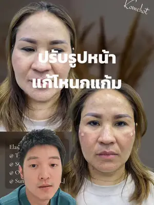 Video cover: Video from Doctor Top Clinic · 2026-03-15