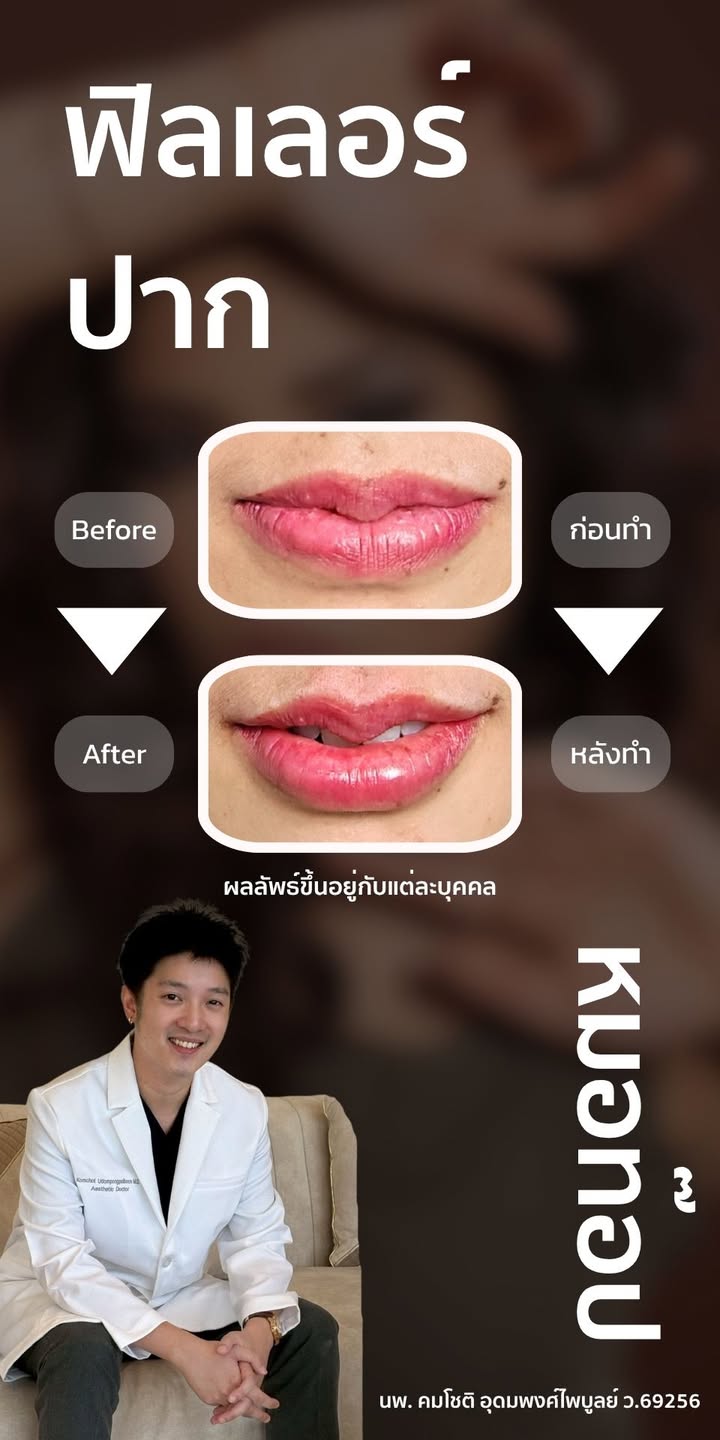 ภาพที่ 1 จากโพสต์ Facebook ที่หมอท๊อปคลินิกเลือกเผยแพร่
