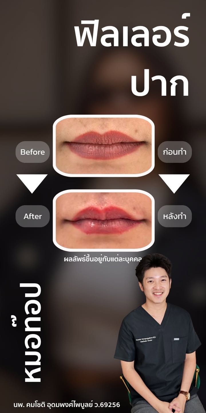 ภาพที่ 1 จากโพสต์ Facebook ที่หมอท๊อปคลินิกเลือกเผยแพร่