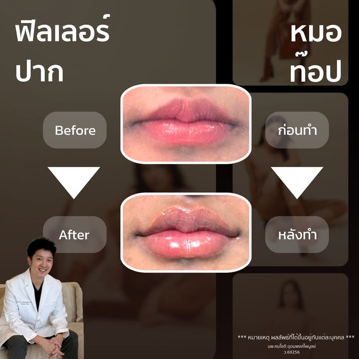 ภาพที่ 1 จากโพสต์ Facebook ที่หมอท๊อปคลินิกเลือกเผยแพร่