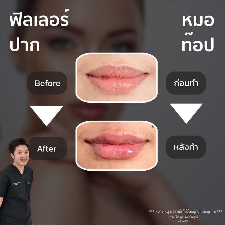 ภาพที่ 1 จากโพสต์ Facebook ที่หมอท๊อปคลินิกเลือกเผยแพร่