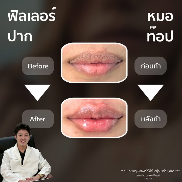 ภาพที่ 1 จากโพสต์ Facebook ที่หมอท๊อปคลินิกเลือกเผยแพร่