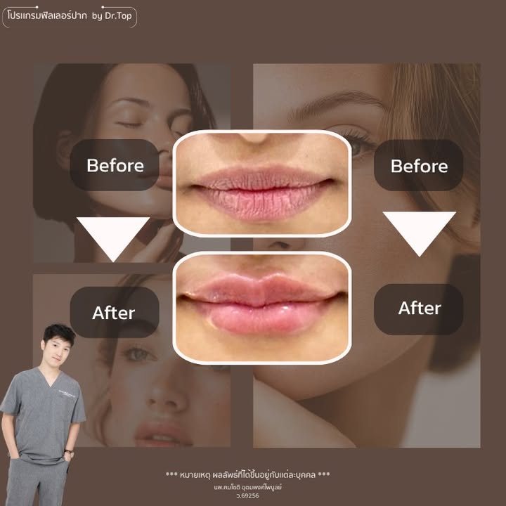 ภาพที่ 1 จากโพสต์ Facebook ที่หมอท๊อปคลินิกเลือกเผยแพร่