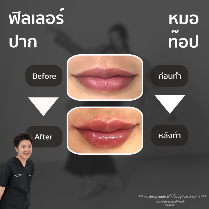 ภาพที่ 1 จากโพสต์ Facebook ที่หมอท๊อปคลินิกเลือกเผยแพร่