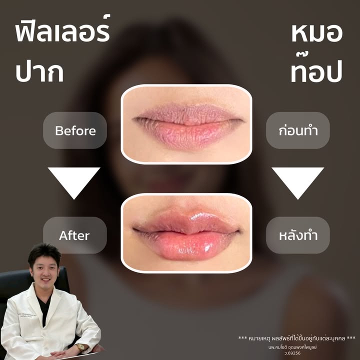 Photo 10 from a published Facebook post by Doctor Top Clinic
