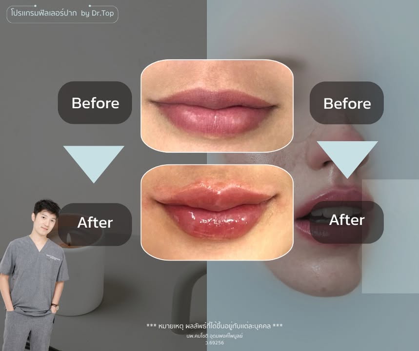 ภาพที่ 1 จากโพสต์ Facebook ที่หมอท๊อปคลินิกเลือกเผยแพร่