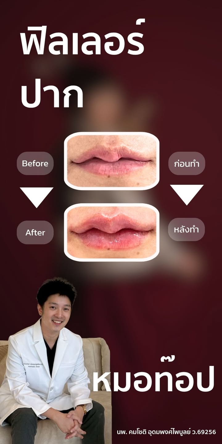 ภาพที่ 1 จากโพสต์ Facebook ที่หมอท๊อปคลินิกเลือกเผยแพร่