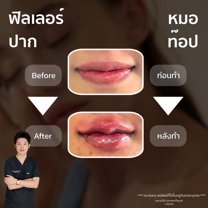 ภาพที่ 1 จากโพสต์ Facebook ที่หมอท๊อปคลินิกเลือกเผยแพร่