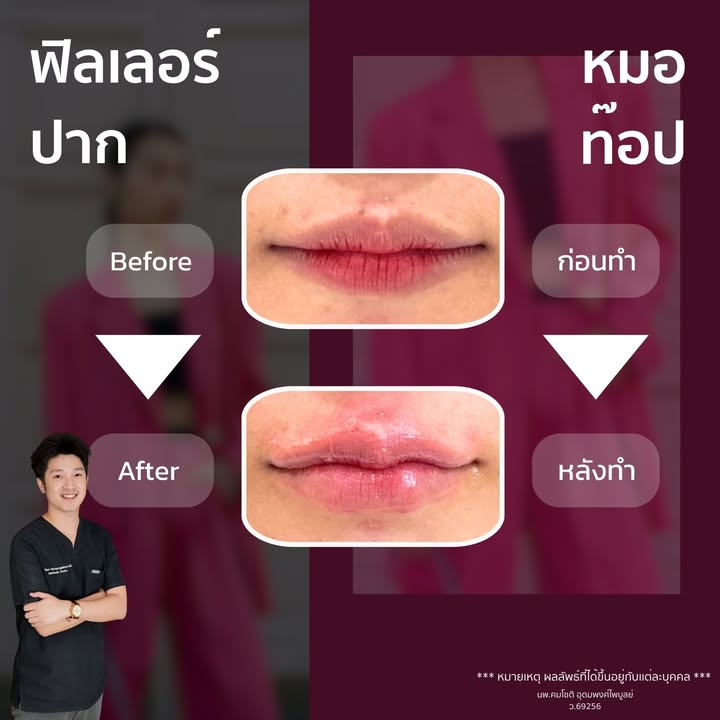ภาพที่ 1 จากโพสต์ Facebook ที่หมอท๊อปคลินิกเลือกเผยแพร่