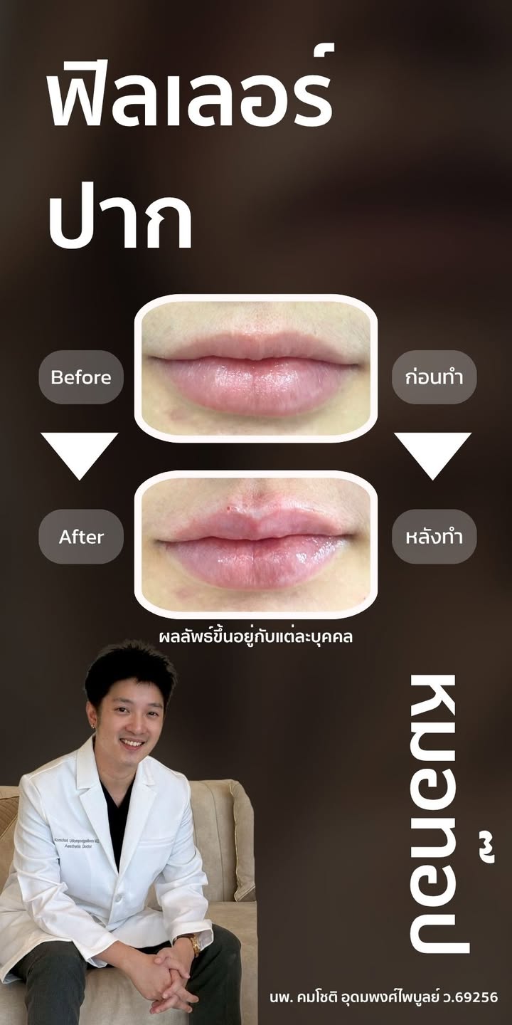 ภาพที่ 1 จากโพสต์ Facebook ที่หมอท๊อปคลินิกเลือกเผยแพร่